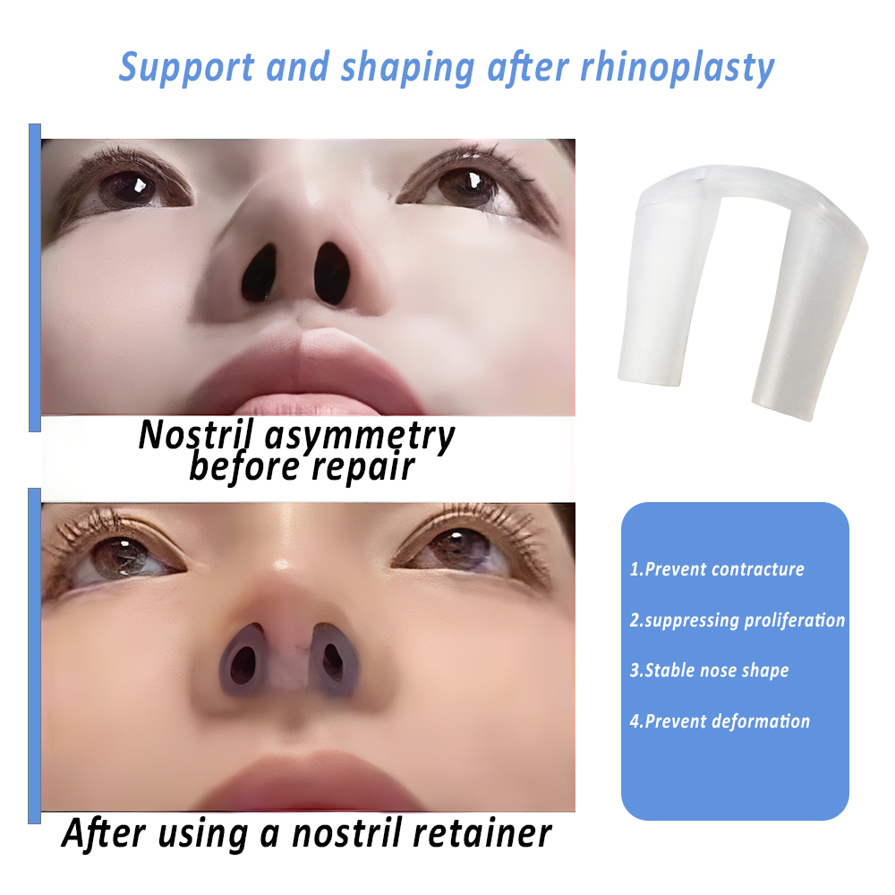 Nostril Retainer for Rhinoplas - Anti Snore Contour Pillow ulasan dan harga